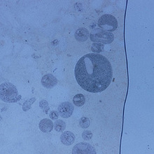 Ichthyophthirius Microscope photo