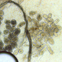 Oodinium Microscope photo