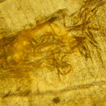Fungus Microscope photo