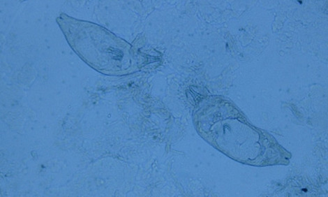 کرمها پوست، gyrodactylus، ترماتود منوژن flatworms