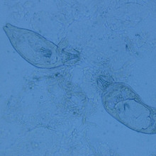 live bearing Gyrodactylus with embryos