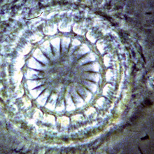 Trichodina, Microscope photo