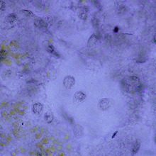 Chilodonella, Microscope photo