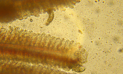 Skin flukes, gyrodactylus, monogenetic flukes, flatworms