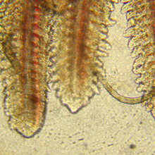 gills with gill flukes, microscope photo