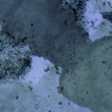 Kopf eines Bandwurmes, Mikroskopbild