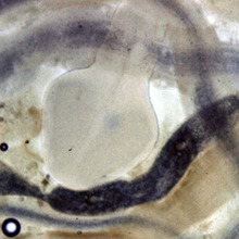 Bandwurm Vorderteil, Mikroskopbild