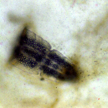 Cercarie Mikroskopbild