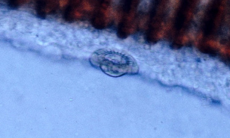 Ectoparasites